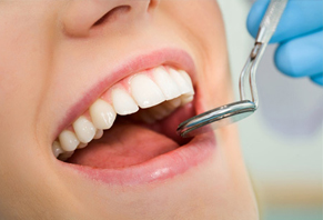 Endodoncia Clinica Dental Concepcion